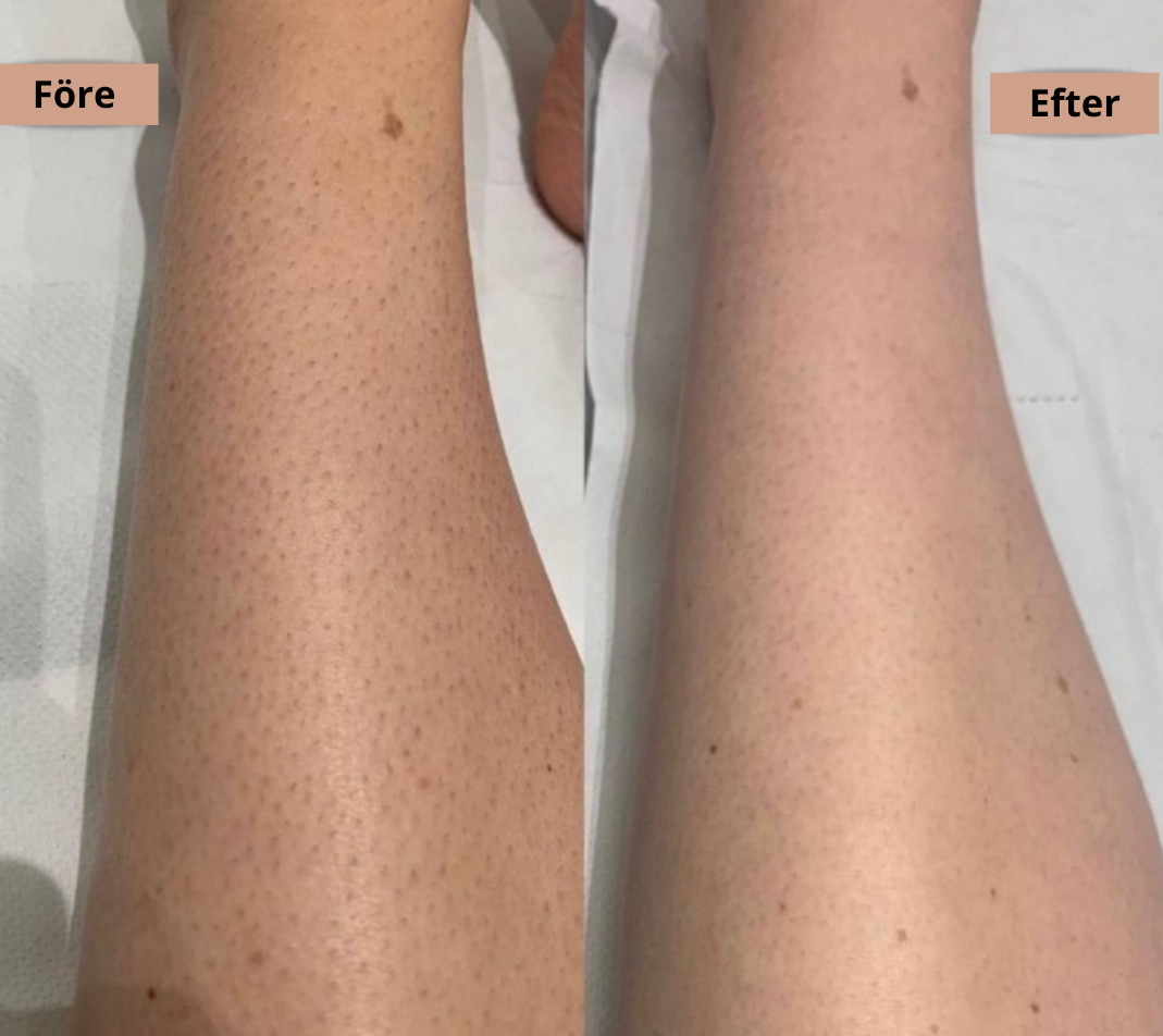 Hårborttagningsolja - Len hud utan rakhyvel