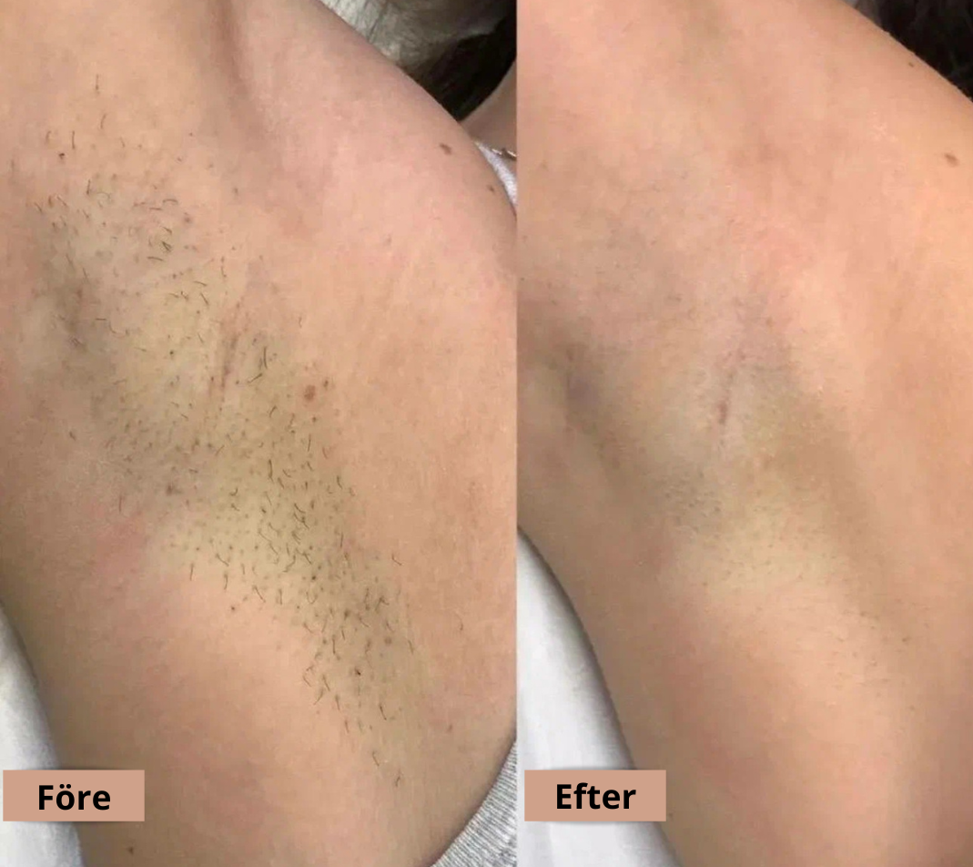 Hårborttagningsolja - Len hud utan rakhyvel