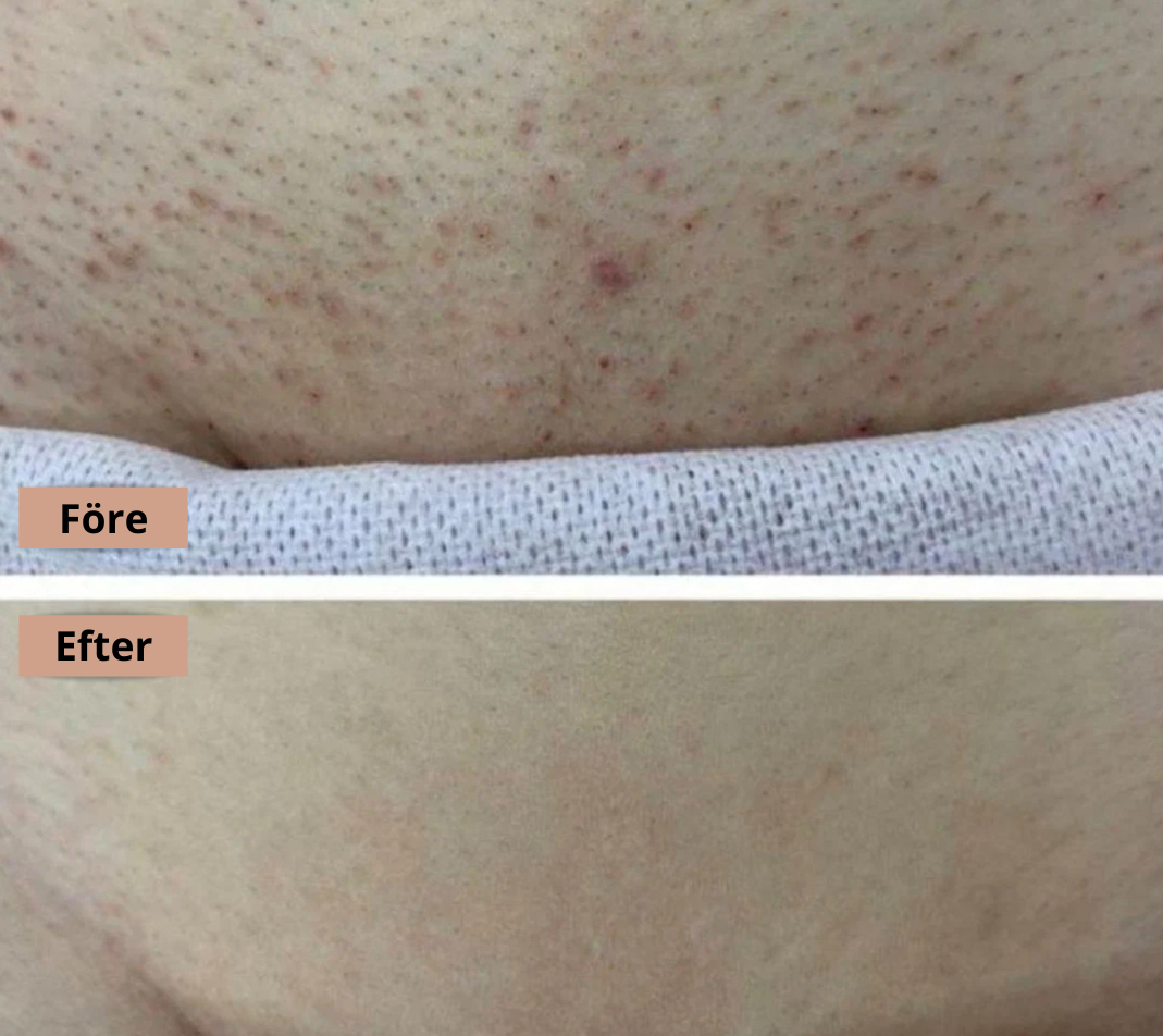 BareLush - Skonsam rakning som låter din hud andas!